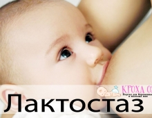 лечение лактостаза народными средствами